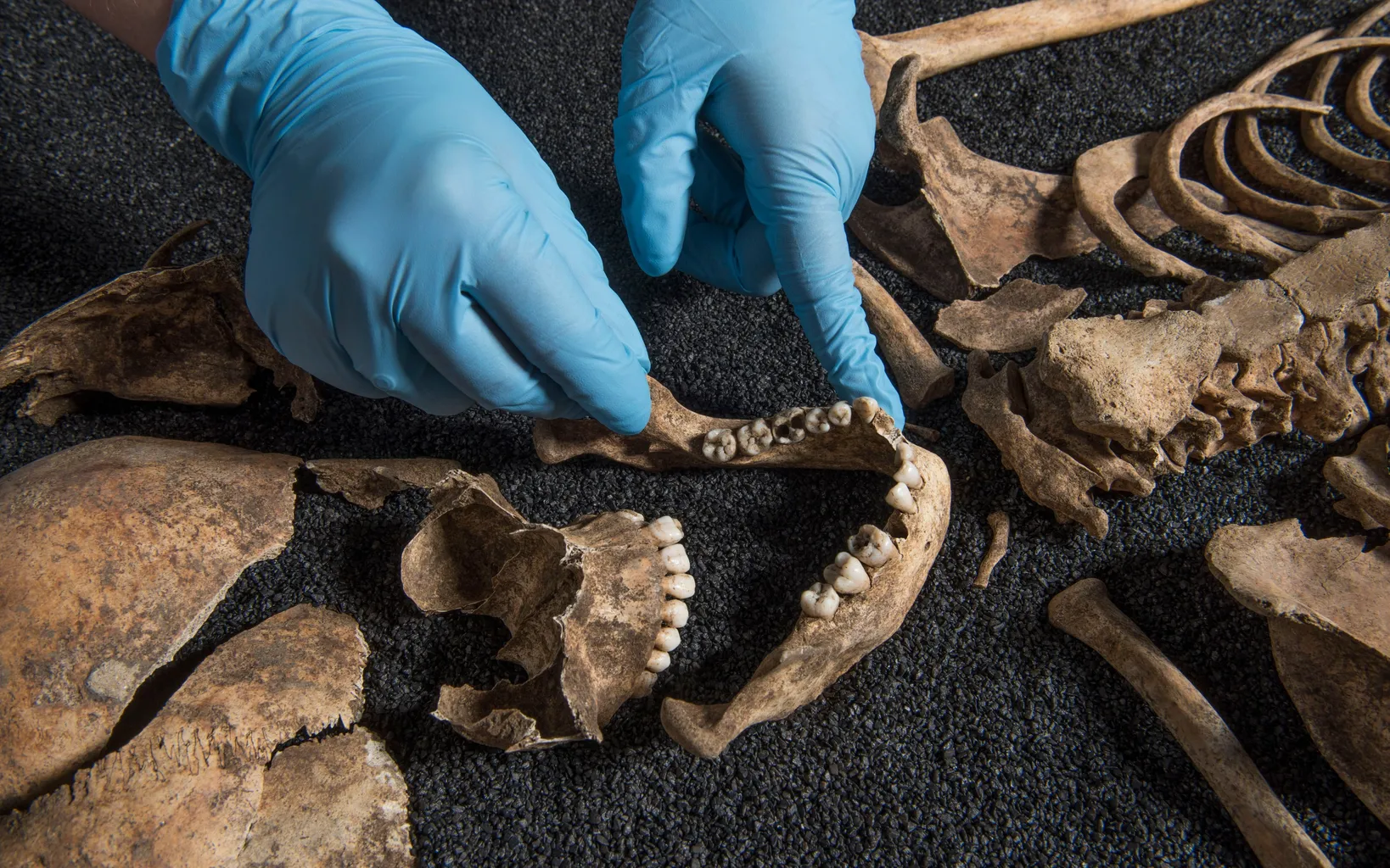 Gloved hands examine a human skeleton laid out on a dark surface, focusing on the jawbone and teeth.